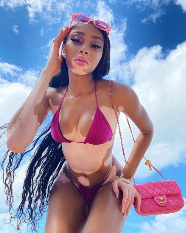 girleak.com > Winnie Harlow > Winnie Harlow Has Fun In Tiny Bikini (7 Photos And Video)_67d77c2c95b1b.jpeg