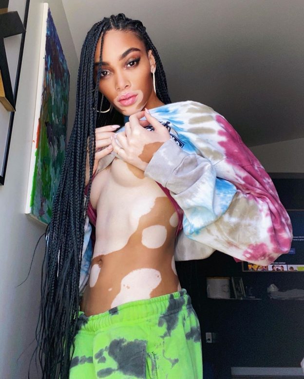 girleak.com > Winnie Harlow > Winnie Harlow Sexy After Two Months Of Self-Isolation (6 Photos)_67d7830100b68.jpeg - photo & video leak - 8962 - 2025-04-25 - By admin